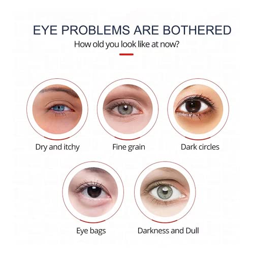 ?Fiore Eye Cream: Awaken tired eyes? - Image 5