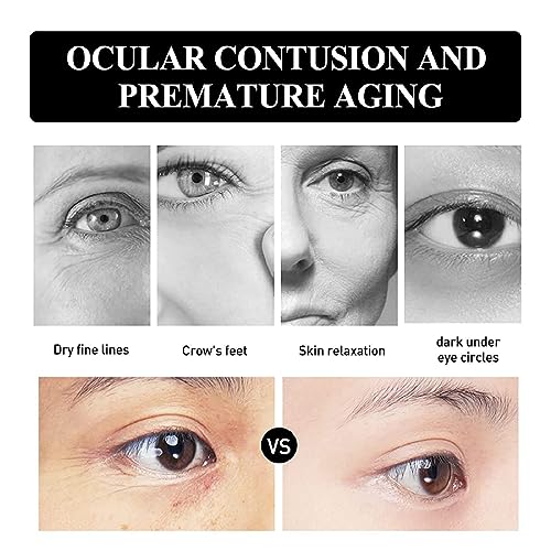 Firming Eye Cream 0.5 oz for Dark Circles and Puffiness Anti-Aging Formula - Image 5