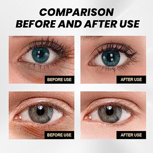 Firmx 0.5 oz Anti-Aging Eye Cream for Youthful, Radiant Eyes - Image 4