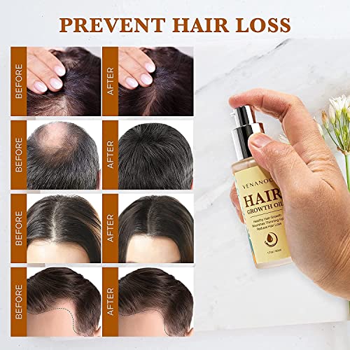 Fitish 2 oz Serum for Healthy and Shiny Hair Treatment - Image 2