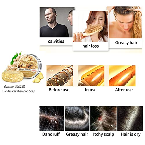 Body Shop Ginger Anti Dandruff Shampoo 250ml for Effective Scalp Care - Image 4