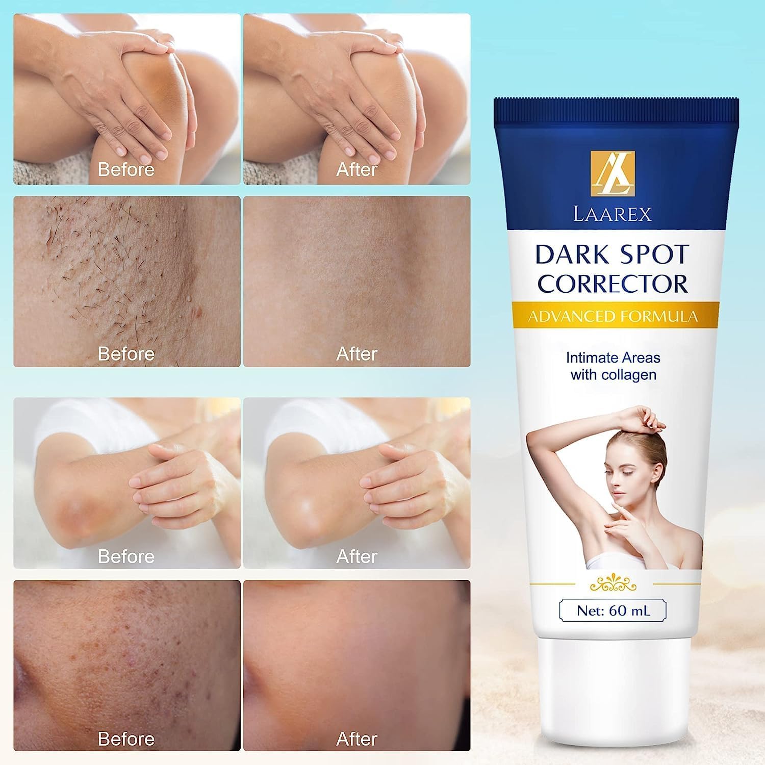 8 oz Nourishing Moisturizing Elbow Treatment Cream for All Skin Types - Image 5