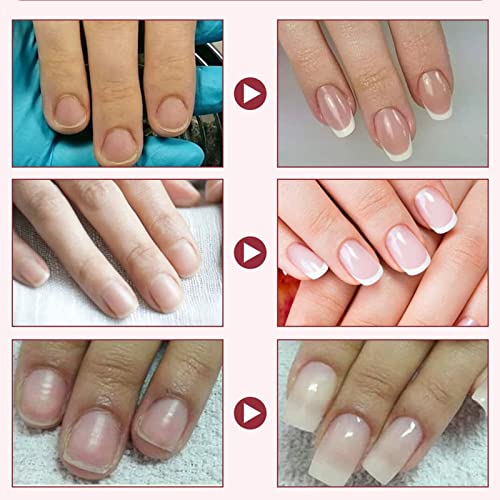10ml Cracked Gel Nail Quick Repair Kit - Easy Application - Image 5