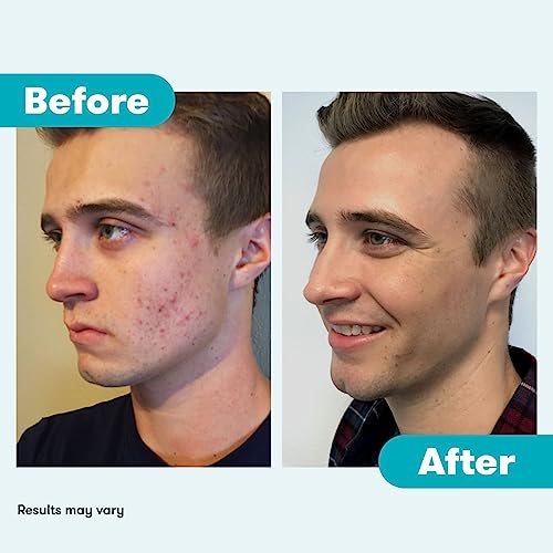 Redefine Eye Cream by Rodan And Fields - Image 8