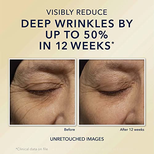 Roc Anti-Aging Eye Cream 0.5 oz Hydrating Formula for Youthful Eyes and Dark Circles - Image 4