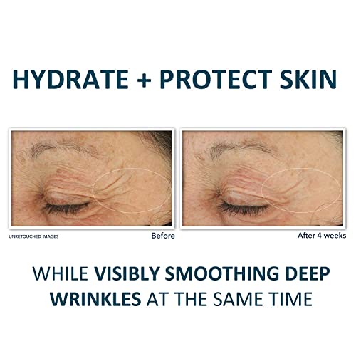 Roc Eye Cream 0.5 oz for Dark Circles and Puffiness - Image 3