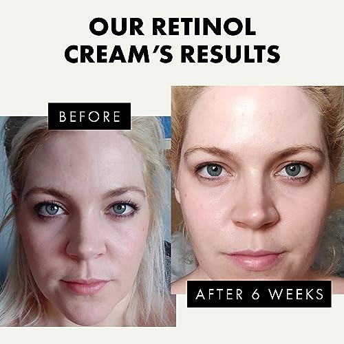 Roc Retinal 0.5 oz Anti-Aging Eye Cream for Youthful Skin - Image 2