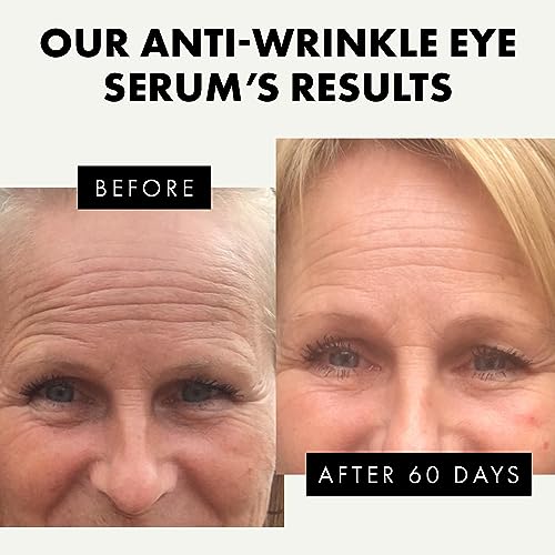Roc Retinol Eye Cream 0.5 oz for Anti-Aging and Dark Circle Treatment New - Image 2