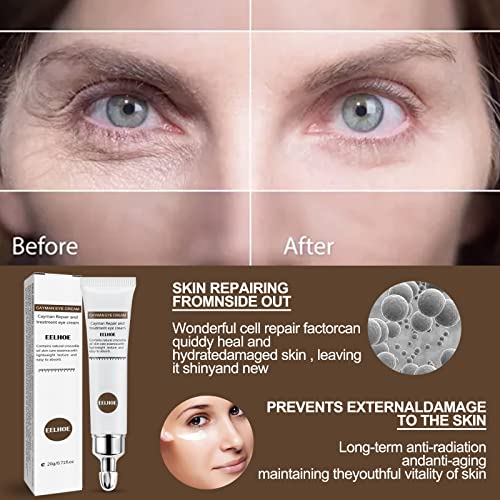 Roc Retinol Eye Cream 0.5 oz Dark Circle & Fine Line Reducer - Image 8