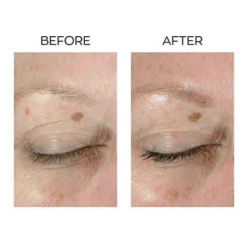 Rox Revitalizing Eye Cream 0.5 oz Jar for Dark Circles and Puffiness - Image 5