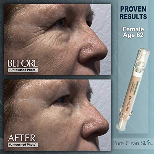 15ml Hydrating Syringe Eye Cream for Dark Circles and Puffiness - Image 4