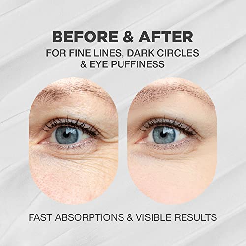 UK Anti Ageing Eye Cream - Image 2