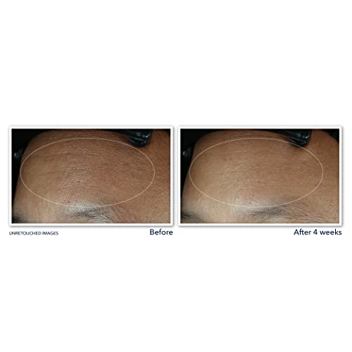 Youthful Eye Cream for Anti Aging - Image 7