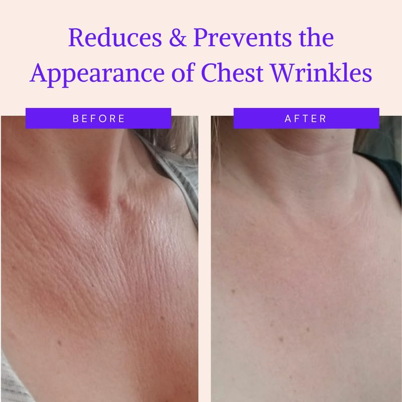 ?Face & Neck Lifting Stick for Wrinkles? - Image 2