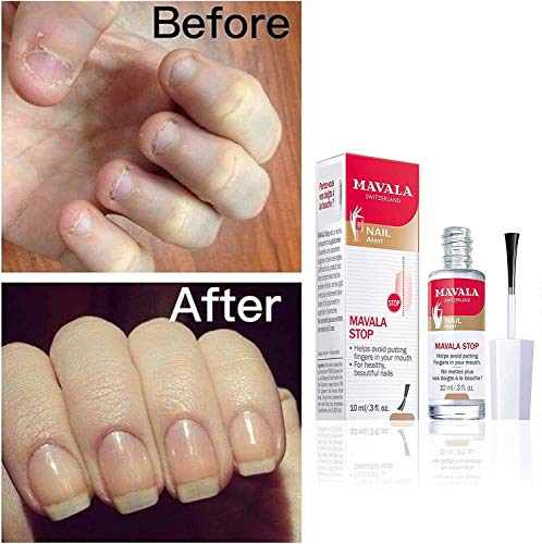 ?Nail Polish to Stop Biting Nails? - Image 4