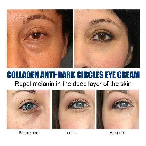 Budget-friendly eye cream for dark circles. - Image 4