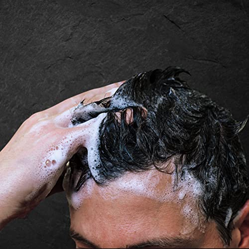 ?Bikers Dandruff Shampoo? - Image 6