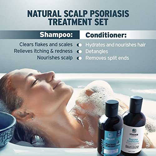Fungal infection treatment with anti-dandruff shampoo. - Image 3