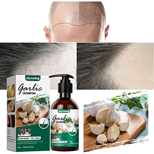 ?Antifungal Dandruff Shampoo? - Image 4