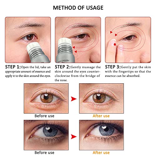 ?Eye Roll On for Wrinkles? - Image 7