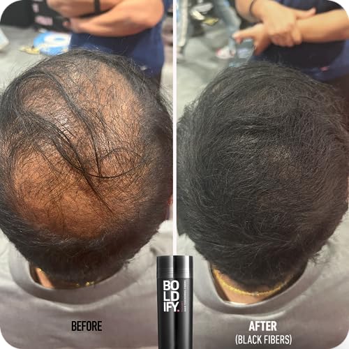 ?Gray hair prevention spray for youthful hair color? - Image 6