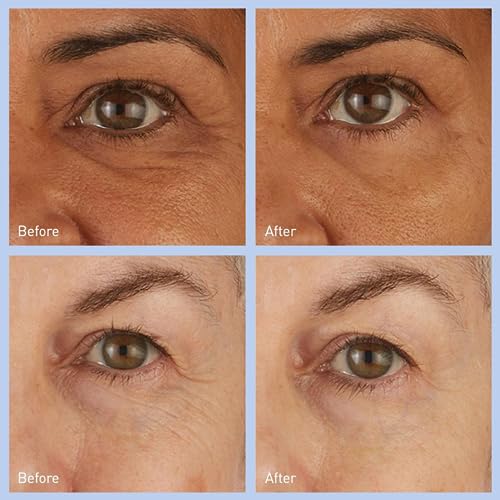 Under Eye Patches for Wrinkles - Image 3
