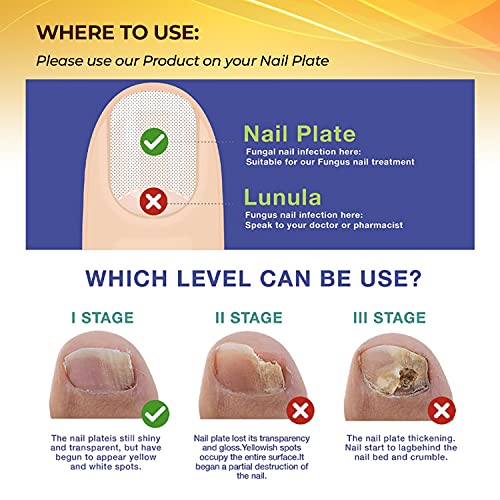 Antifungal nail polish for healthy nails. - Image 6