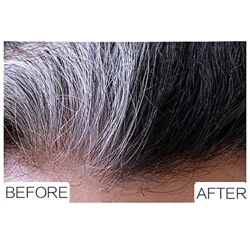 Argan Oil Shampoo Allergy: Caution for Sensitivity - Image 5
