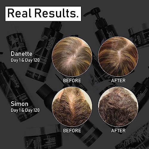 ?Age-defying hair care for youthful locks? - Image 7