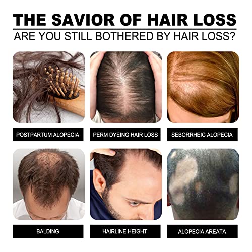 ?Antifungal Dandruff Shampoo? - Image 6