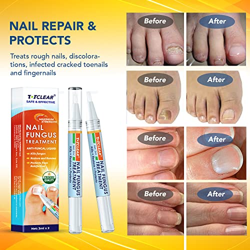 Antifungal nail polish for healthy nails. - Image 3