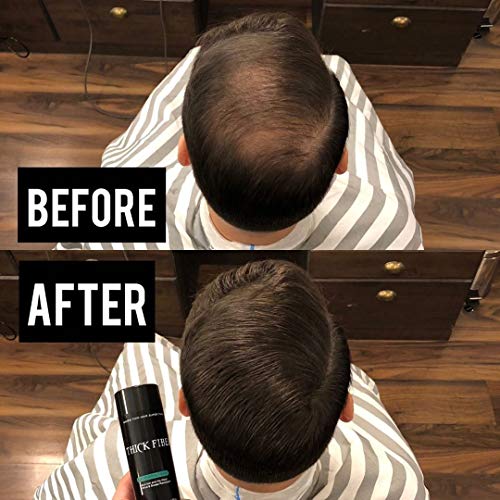 ?Bald Hair Spray: Instantly regrow hair with this miracle spray!? - Image 4