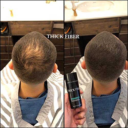 ?Bald Hair Spray: Instantly regrow hair with this miracle spray!? - Image 5