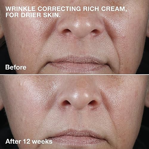 Clinique Anti-Aging 0.5 oz Eye Cream for Dark Circles and Puffiness Reduction - Image 3