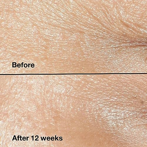 Clinique Anti-Aging 0.5 oz Eye Cream for Dark Circles and Puffiness Reduction - Image 2