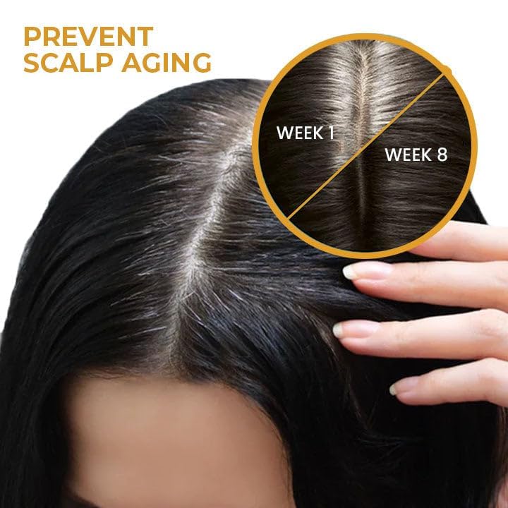 Dandruff-fighting shampoo for healthy hair. - Image 8