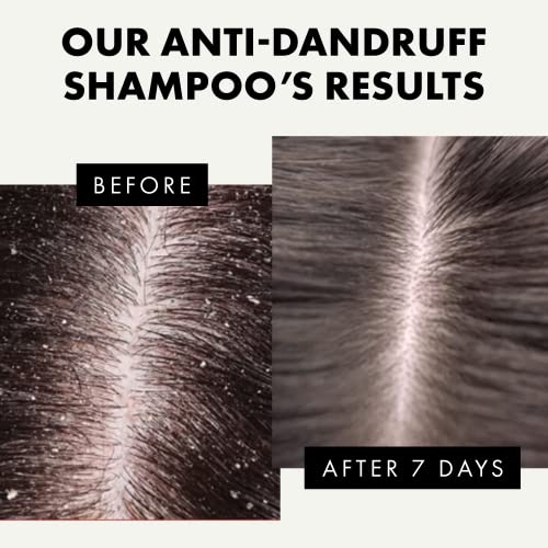 Dermatologist Recommended Anti-Dandruff Shampoo for Flake Control 12 oz Bottle - Image 2