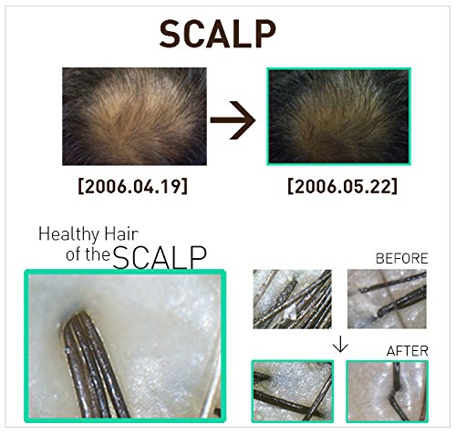 Doctor Recommended Anti Dandruff Shampoo - Image 8