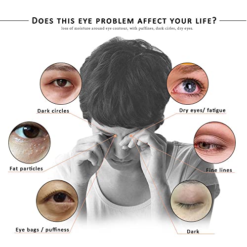 ?Eye Roll On for Wrinkles? - Image 8