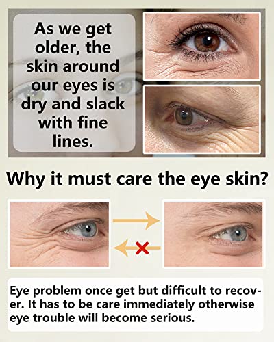 Eye treatments for reducing wrinkles. - Image 6