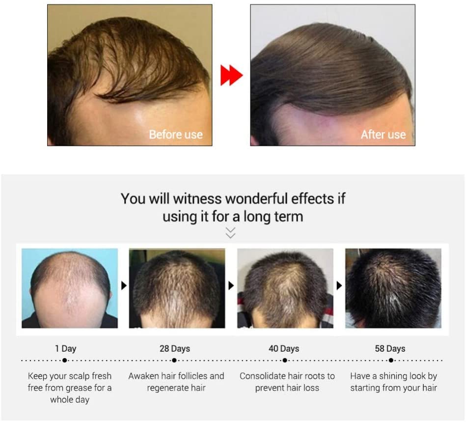 ?Herbal Hair Conditioner by Atomy? - Image 4