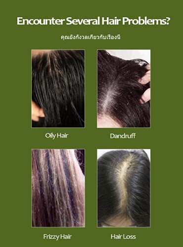 Herbal shampoo fights dandruff. - Image 5