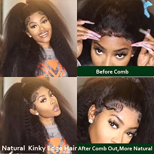 ?Kinky Afro Human Hair Full Lace Wig? - Image 8