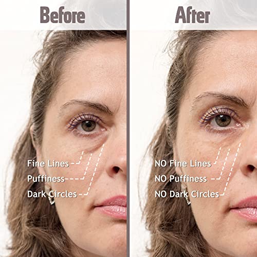 Pure Organic Argan Oil 30ml - Soothes Under Eye Puffiness and Diminishes Dark Circles - Image 2