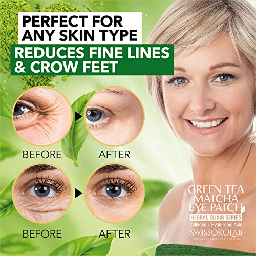 Under Eye Anti-Wrinkle Solution - Image 6