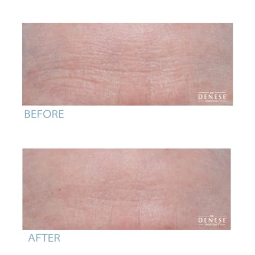 Dr. Denese Anti-Aging Eye Cream 1.7 oz for Youthful, Revitalized Skin - Image 4