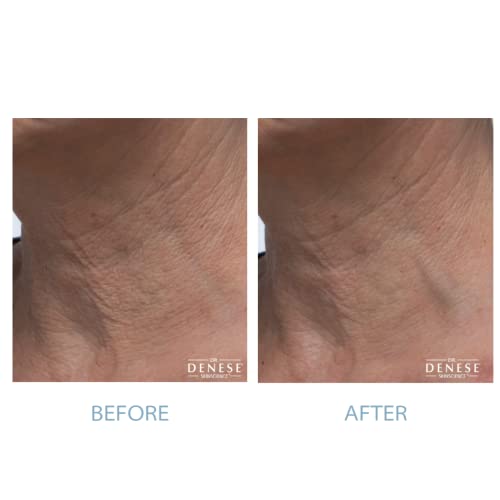 Dr. Denese Anti-Aging Eye Cream 1.7 oz for Youthful, Revitalized Skin - Image 5