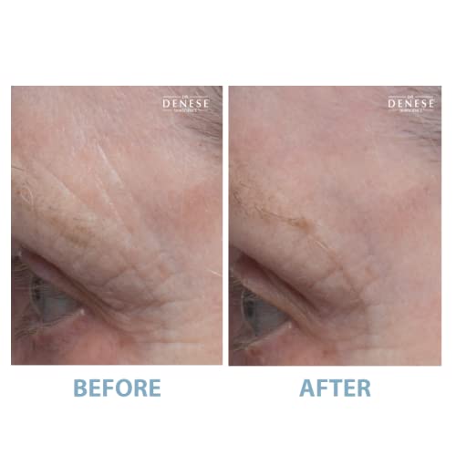 Dr. Denese Anti-Aging Eye Cream 1.7 oz for Youthful, Revitalized Skin - Image 6