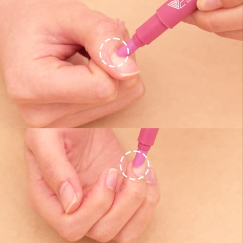 Irritated Nail Cuticle - Image 7