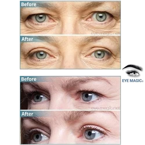 TV?s Magic Eye Cream for reducing wrinkles and dark circles. - Image 3
